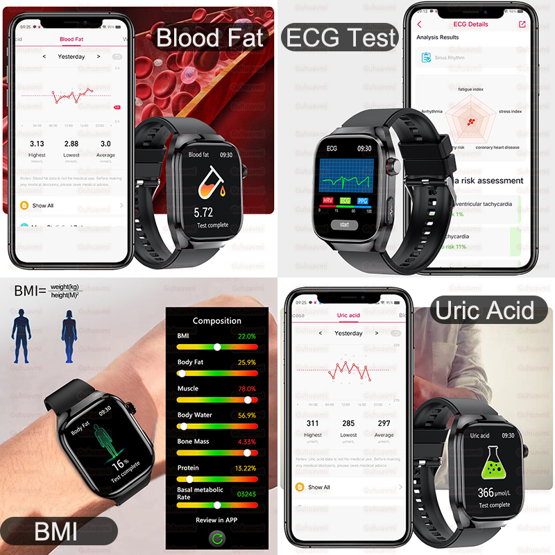 2025년 신형 고정밀 스마트워치 오관검사 ECG 실시 - Smart Home Energy Management 리뷰 및 가격
